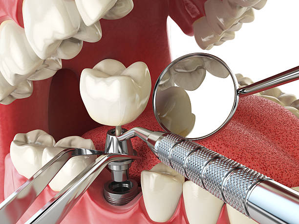 Best Walk-In Emergency Dentist in Big Sky, MT